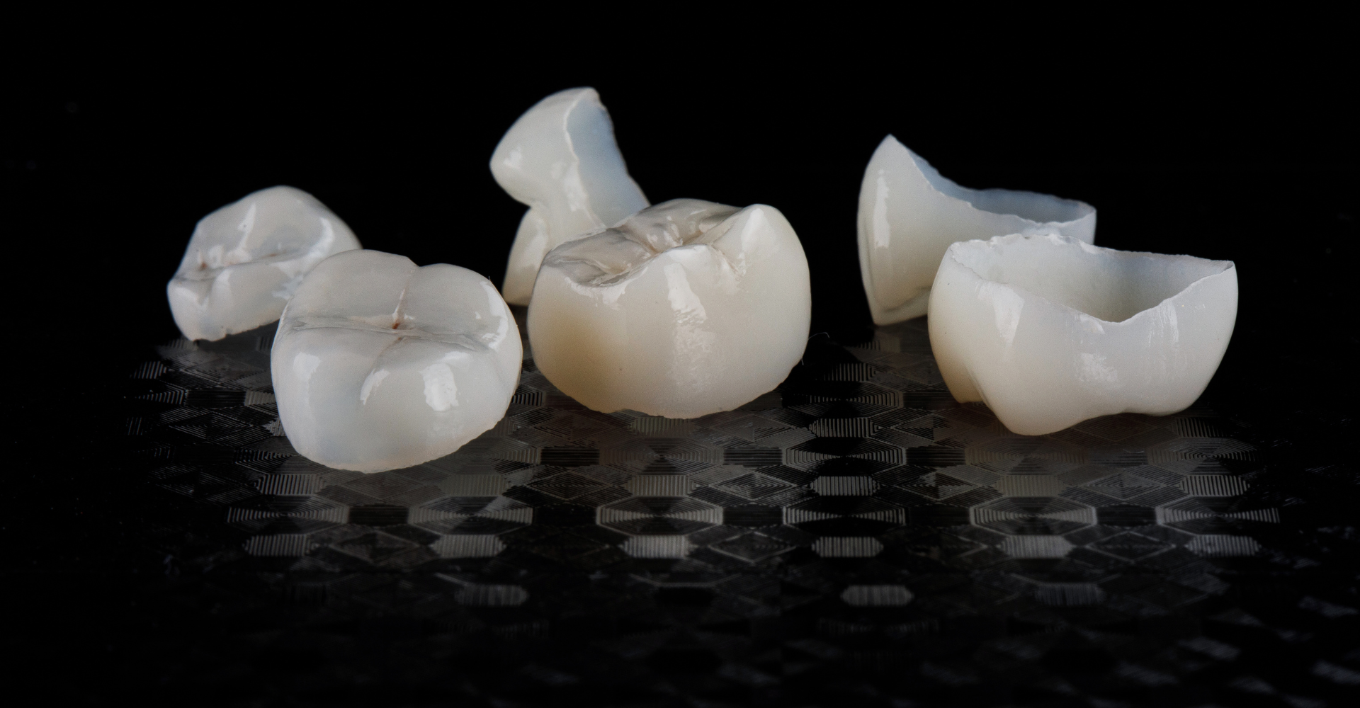 Excellent composing of ceramic dental crowns at Jordan Landing Dental Care